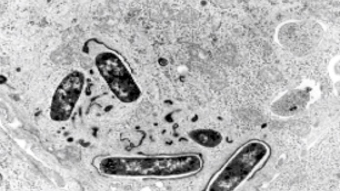 赤痢 菌 発見 者 菌 者 赤痢 発見