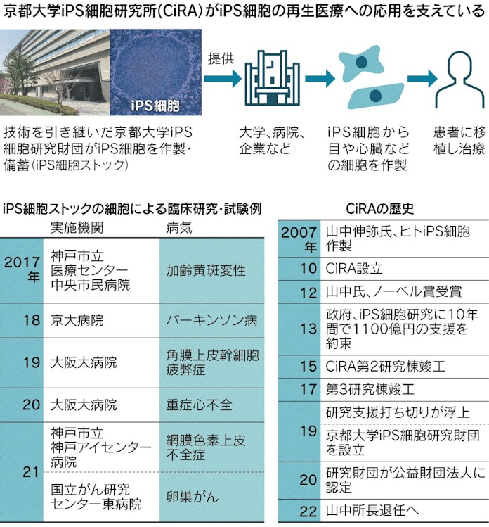Ips 治療応用へ正念場 日本経済新聞 Ips 治療応用へ正念場 日本経済新聞
