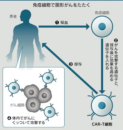 免疫細胞で 臓器がん 治療 中国新興や武田が治験 日本経済新聞 免疫細胞で 臓器がん 治療 中国新興や武田が治験 日本経済新聞