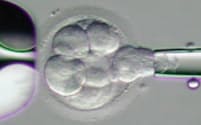分裂した受精卵から細胞をガラス管で吸い出し検査する（吉村泰典慶応大名誉教授提供）