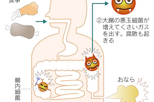 おならがたくさん出て困る 原因は腸内バランス Nikkei Style
