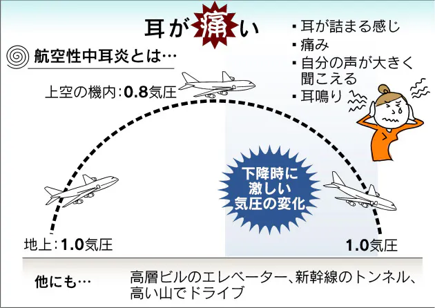 飛行機に乗ると耳が痛い 航空性中耳炎 秋冬は要注意 Nikkei Style