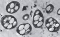 電子顕微鏡で観察した細菌の内部=米科学誌サイエンス提供