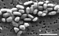 見つかった細菌の電子顕微鏡写真=米科学誌サイエンス提供・共同