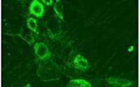 TRPV2がある神経細胞の光学顕微鏡写真(生理学研の富永教授提供)