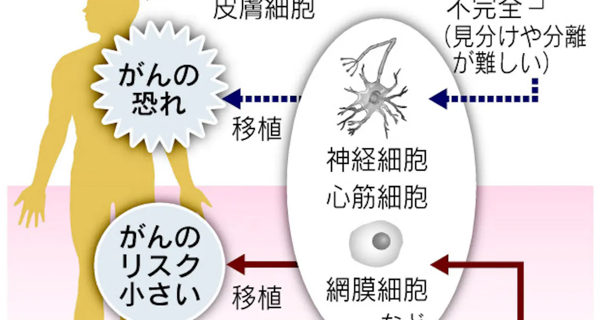 Ips細胞の発がん防ぐ新製法 山中教授ら再生医療へ一歩 日本経済新聞