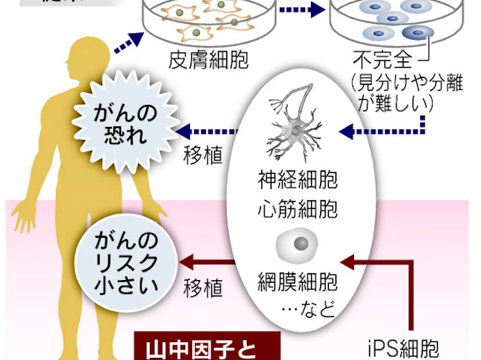 Ips細胞の発がん防ぐ新製法 山中教授ら再生医療へ一歩 日本経済新聞