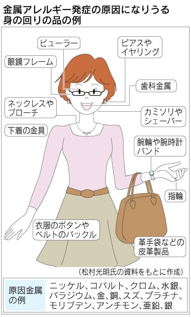 歯の治療 楽器演奏 金属アレルギー思わぬところで Nikkei Style 歯の治療 楽器演奏 金属アレルギー思わぬところで Nikkei Style