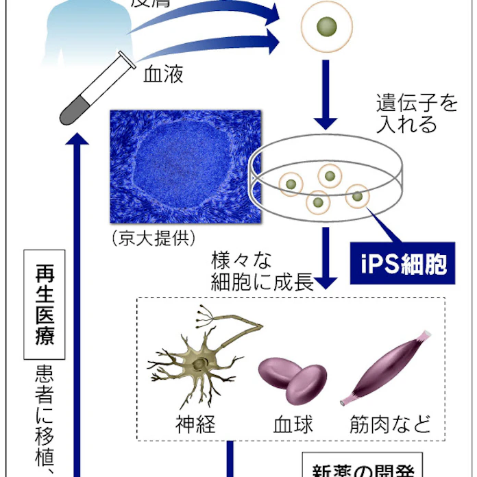 Ips細胞 再生医療の切り札 難病への効果期待 日本経済新聞