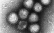 中国で流行している鳥インフルエンザウイルス「H7N9」の電子顕微鏡写真(国立感染症研究所提供)