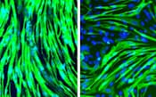 ヒトのiPS細胞から作った緑色に光る細長い骨格筋細胞(左)と三好型筋ジストロフィーの患者のiPS細胞から作った骨格筋細胞(京都大iPS細胞研究所の桜井英俊講師提供)=共同