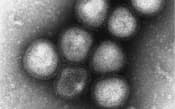 H7N9型鳥インフルエンザウイルスの電子顕微鏡写真(国立感染症研究所提供)=共同