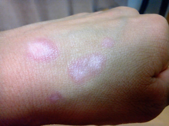 カネボウ 美白化粧品で54製品回収 肌まだらに白く 日本経済新聞 カネボウ 美白化粧品で54製品回収 肌まだらに白く 日本経済新聞