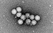 ノロウイルスの電子顕微鏡写真(国立感染症研究所提供)
