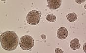 人で初めてのSTAP細胞の可能性がある細胞の顕微鏡写真=バカンティ教授提供・共同