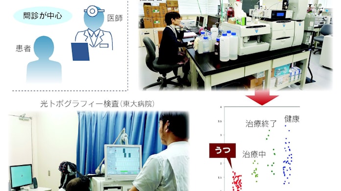 社員の うつ 血液で見抜く 早期発見へ 日本経済新聞