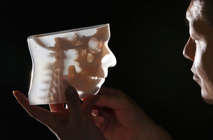 職人の技 人体 に魂 3dプリンター製の医療模型 未来への百景 日本経済新聞
