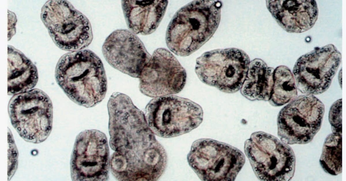 寄生虫エキノコックス 本州で感染拡大の兆し 日本経済新聞 寄生虫エキノコックス 本州で感染拡大の兆し 日本経済新聞