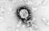 C型肝炎ウイルスの顕微鏡写真（国立感染症研究所提供）