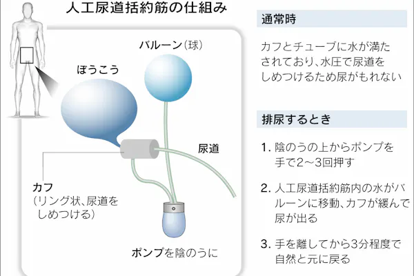 夜中に何度もトイレ 就寝の習慣を見直そう Nikkei Style