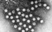 強い感染力をもつノロウイルス（愛知県衛生研究所提供）