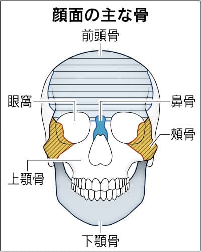 スポーツでの接触 酔って転倒 顔面骨折に注意 Nikkei Style スポーツでの接触 酔って転倒 顔面骨折に注意 Nikkei Style