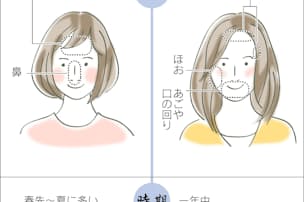あなたの大人ニキビ 原因は 触り癖 Nikkei Style あなたの大人ニキビ 原因は 触り癖 Nikkei Style