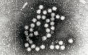 ノロウイルスはわずかな量でも感染を引き起こす（電子顕微鏡写真、大阪市立環境科学研究所提供）