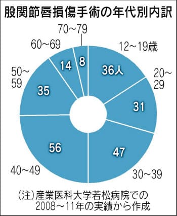 股関節の痛みに新タイプ 働き盛り 運動しすぎ注意 Nikkei Style 股関節の痛みに新タイプ 働き盛り 運動しすぎ注意 Nikkei Style