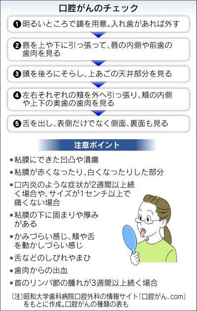 口腔がん 自分で月1回チェック 口内炎と似た症状 2週間続けば注意 Nikkei Style