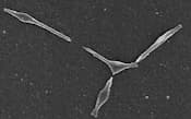 マイコプラズマの電子顕微鏡写真
=国立感染症研究所細菌第二部提供