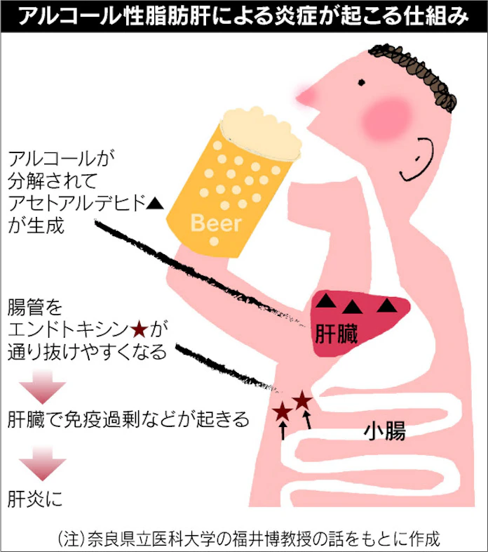 飲み過ぎ食べ過ぎ 脂肪肝になりやすく 肝硬変 がんのリスク上昇 日本経済新聞