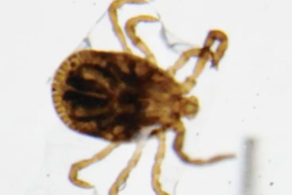 顔ダニ って知ってる 毛穴ひとつに5 6匹 Nikkei Style 顔ダニ って知ってる 毛穴ひとつに5 6匹 Nikkei Style