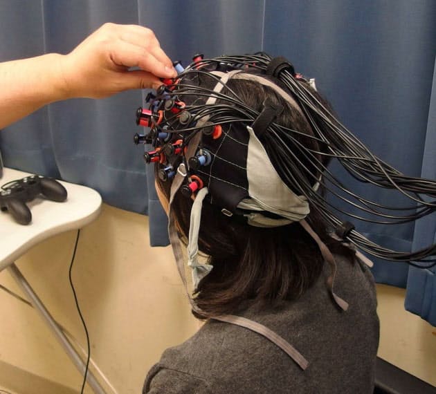 うつ症状 脳血流で見極め 適切な治療に道 Nikkei Style