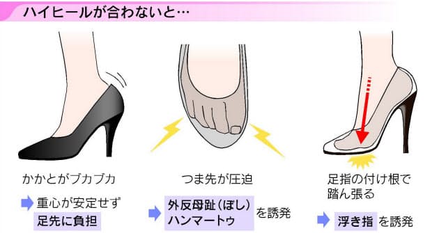 足のトラブル防ぐ ハイヒール選び4つのポイント Nikkei Style 足のトラブル防ぐ ハイヒール選び4つのポイント Nikkei Style