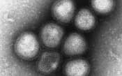 H7N9型鳥インフルエンザウイルスの電子顕微鏡写真（国立感染症研究所提供）