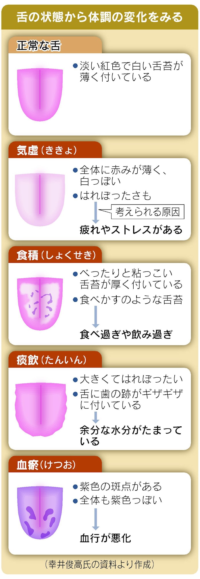 舌を見て体調チェック 白っぽい場合は疲労が蓄積 日本経済新聞 舌を見て体調チェック 白っぽい場合は疲労が蓄積 日本経済新聞