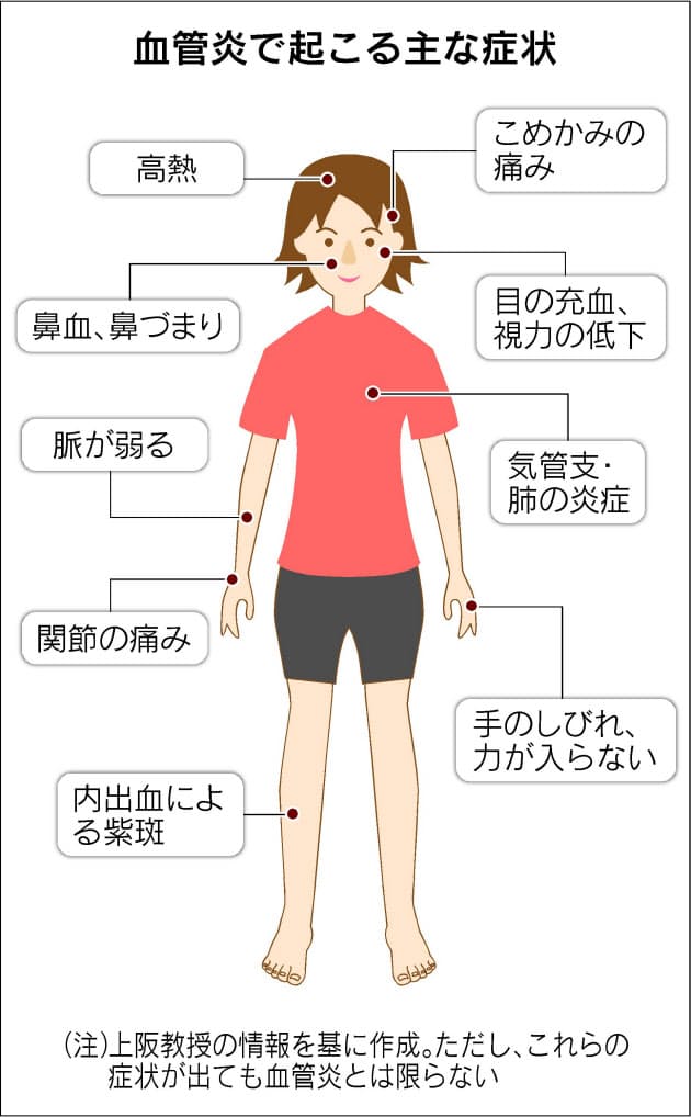 ジャンプ竹内選手が直面した難病 血管炎 とは Nikkei Style ジャンプ竹内選手が直面した難病 血管炎 とは Nikkei Style