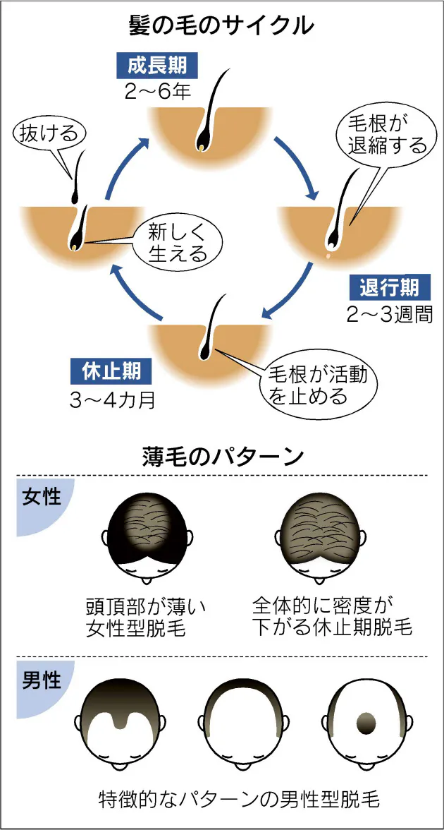 原因さまざま 女性の薄毛 気をつけたいこと Nikkei Style 原因さまざま 女性の薄毛 気をつけたいこと Nikkei Style