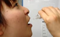 舌下免疫療法では舌の裏にスギ花粉エキスを含む薬を垂らす（日本医科大提供）