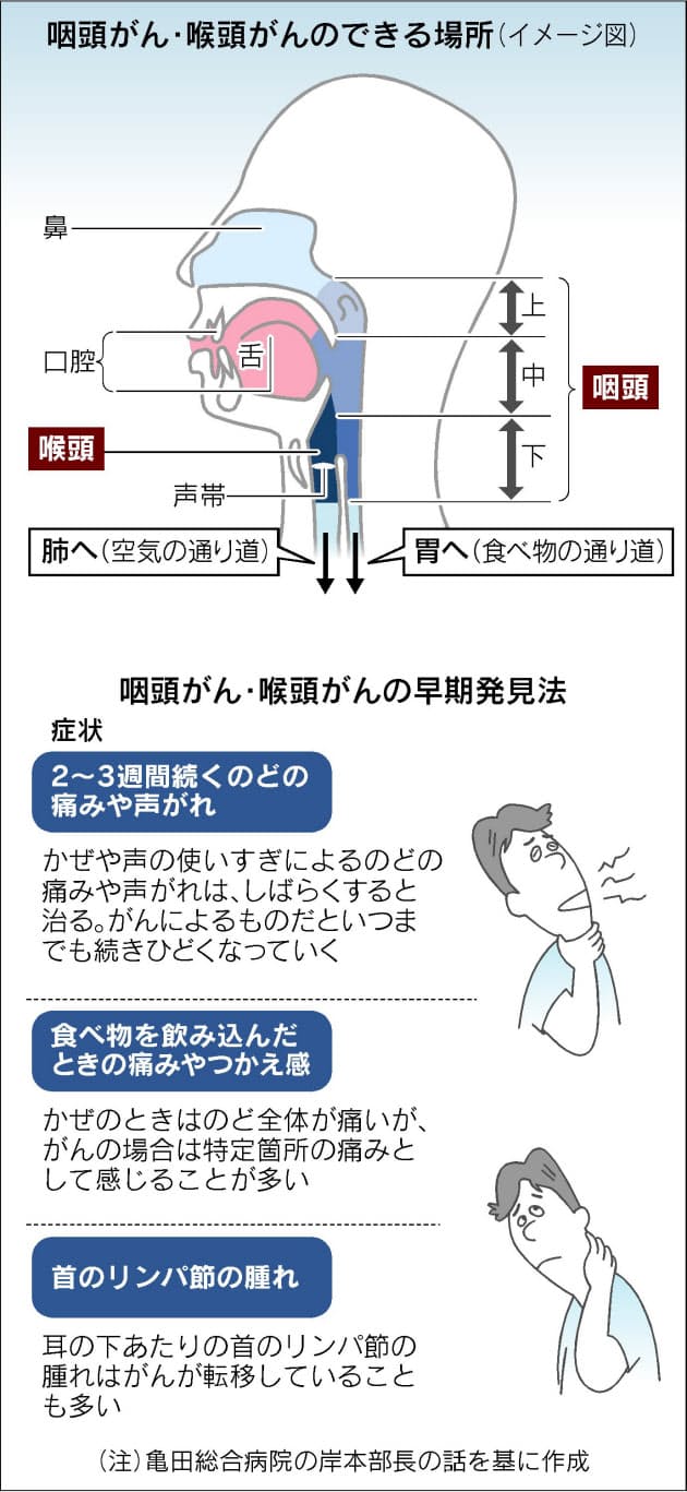 男性に多い喉のがん 声失う前に早期治療を Nikkei Style 男性に多い喉のがん 声失う前に早期治療を Nikkei Style