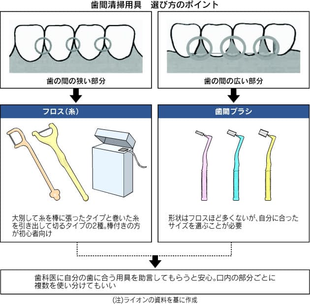 歯間の汚れ除去 フロス 歯間ブラシ使うコツ Nikkei Style 歯間の汚れ除去 フロス 歯間ブラシ使うコツ Nikkei Style