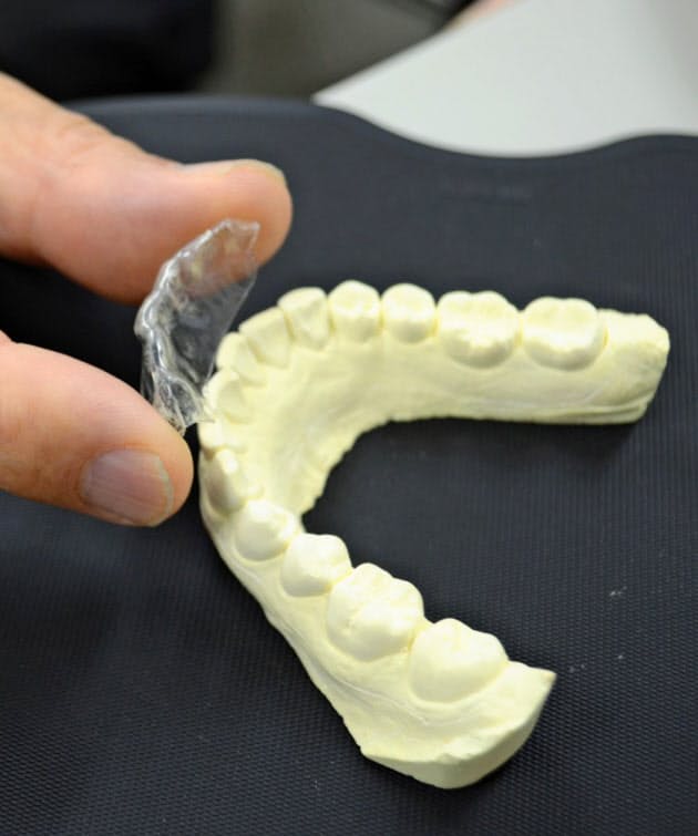 ゲップ おならで悩んだら 呑気症 歯科での治療も Nikkei Style