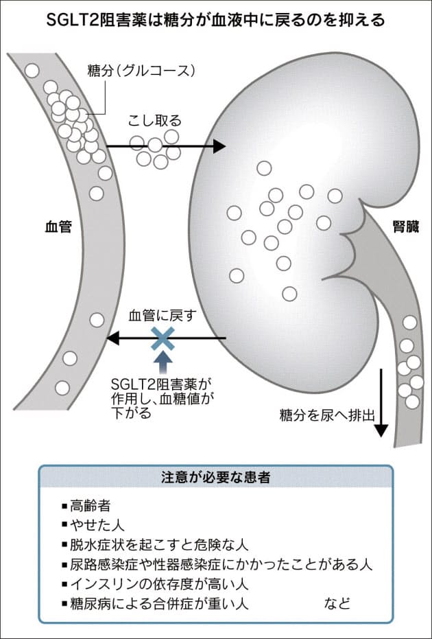 やせる糖尿病薬 私に合う 血中の糖分を尿へ排出 Nikkei Style