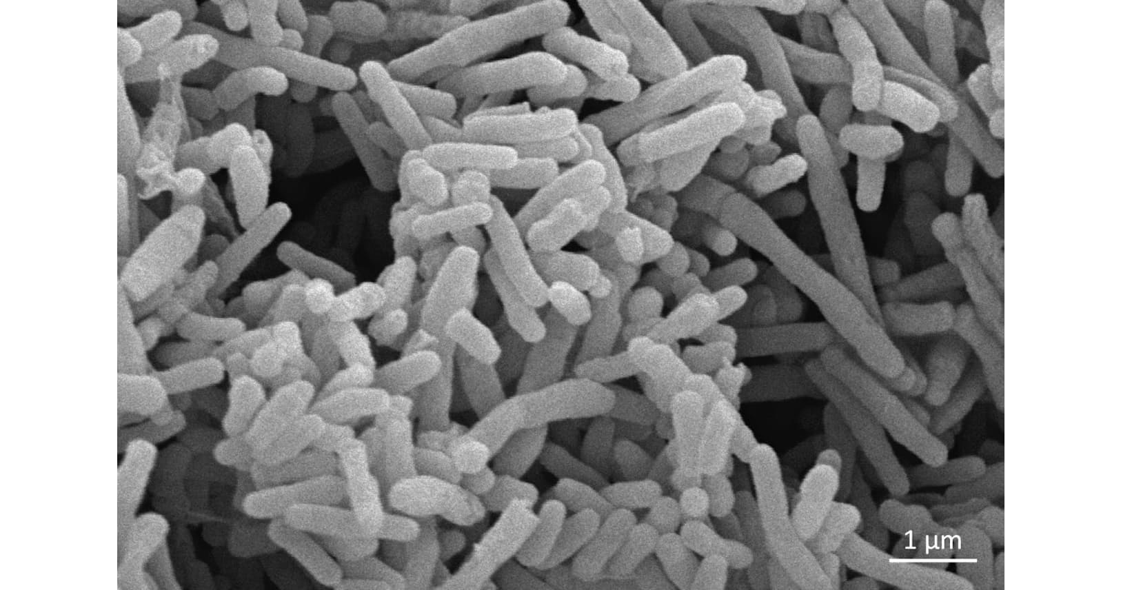 治りにくい咳 中高年で急増 ヘルスup Nikkei Style