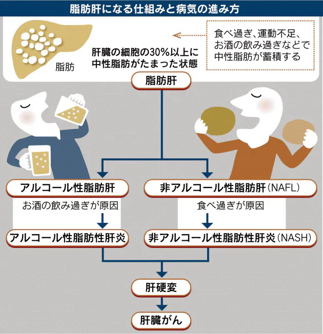 肝臓疾患 アルコール性肝障害 つかざんクリニック