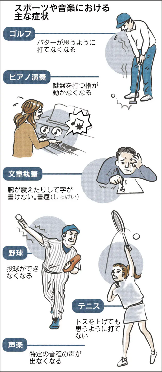 プロ選手 演奏家 突然手が動かなく イップスを知る Nikkei Style
