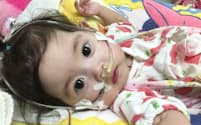 渡米して心臓移植を待つ1歳の女児（親族提供）