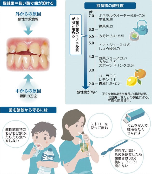 虫歯より深刻 酸蝕歯 ちびちび飲み 歯には負担 Nikkei Style