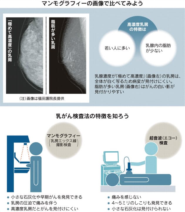 日本に多い脂肪少なめ乳房 乳がん検診見逃しリスク大 Nikkei Style